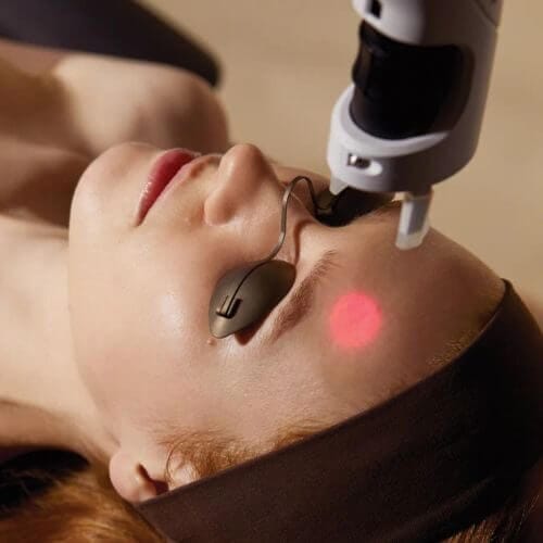 Lumea Laser Skin Resurfacing​