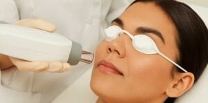 What Is Laser Skin Resurfacing and How Does It Work?